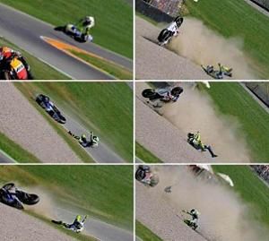 Valentino Rossi: frattura scomposta di tibia e perone, operato Valentino Rossi: frattura scomposta di tibia e perone, operato